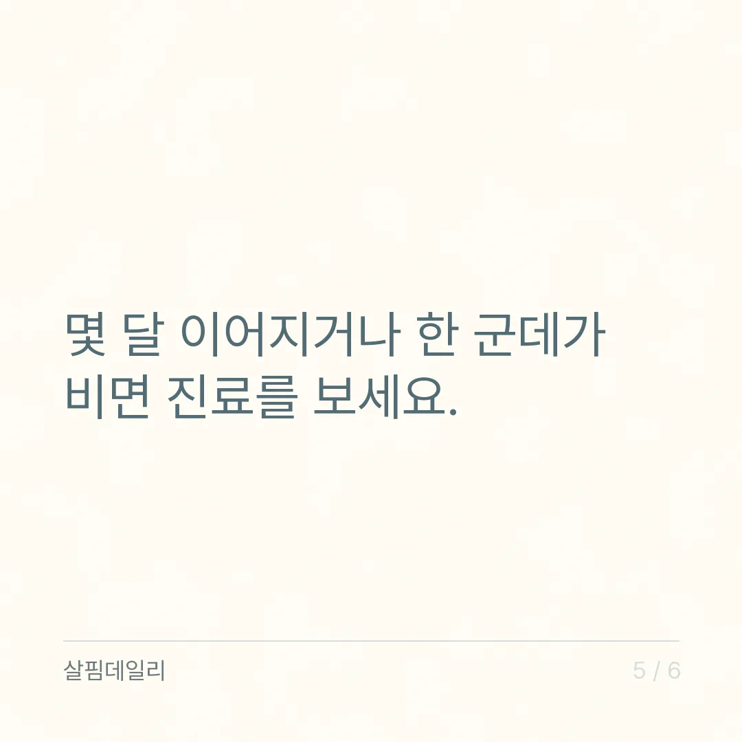 머리카락 하루 몇 개 빠지면 탈모일까, 정상 50~100개와 가을에 늘어 보이는 이유 카드 5