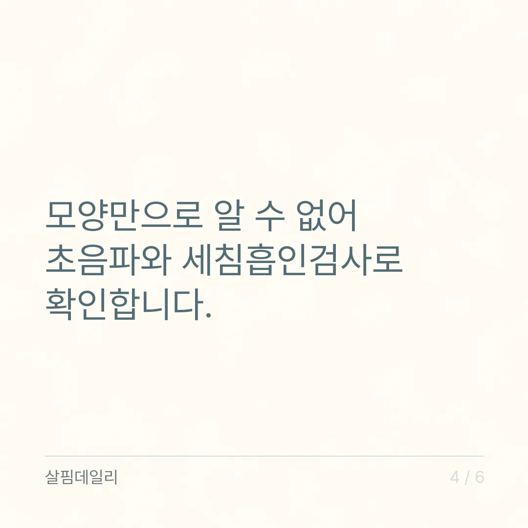갑상선 결절 양성 뜻, 90~95%가 양성인 결절을 6개월~2년마다 지켜보는 이유 카드 4